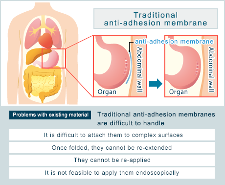 Conventional adhesion preventing membrane