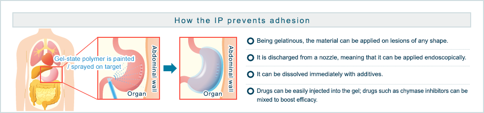 Prevention of adhesion by injectable polymer